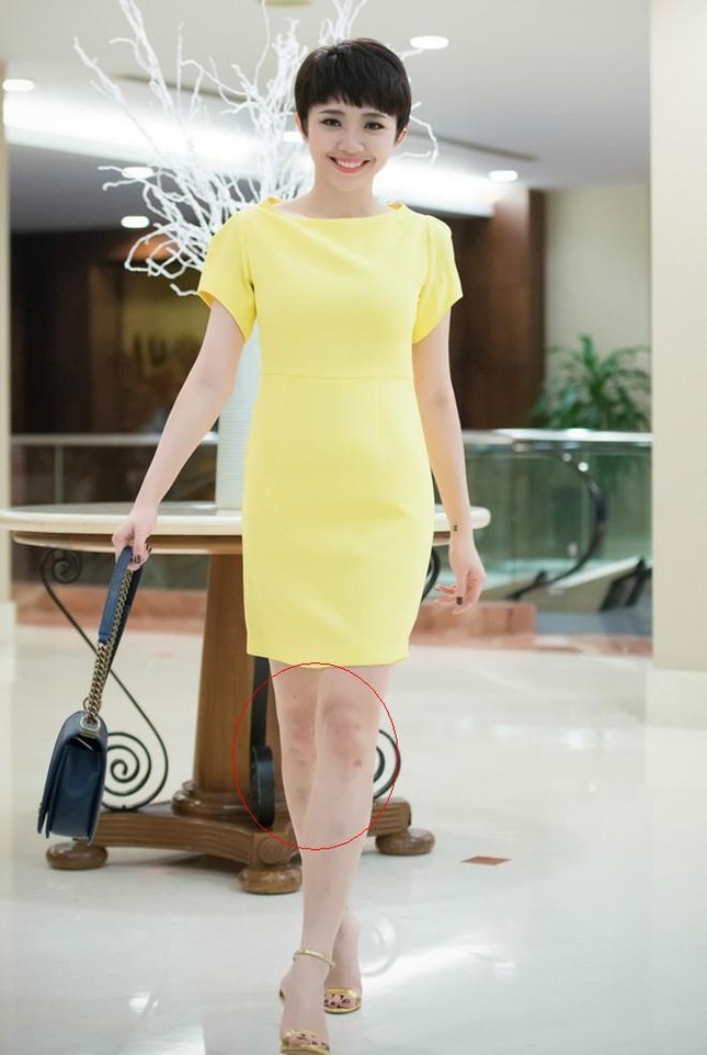 Tóc Tiên khoe chân thon dài đầy sẹo thâm tím với quần short ngắn - ảnh 6