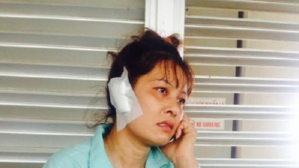 Đi nhậu về, chồng cắn đứt lìa tai vợ - ảnh 1