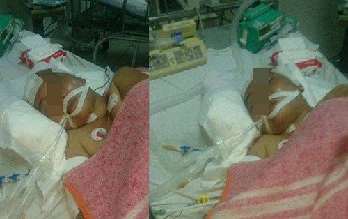 Xót xa con bị thần kinh, mẹ cưa sọ chờ chết sau khi đi chúc Tết - ảnh 1