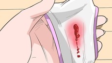 6 dấu hiệu cảnh báo ung thư buồng trứng bạn không nên xem thường