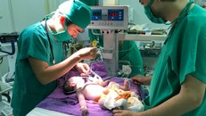 Em bé chào đời với khối thoát vị rốn