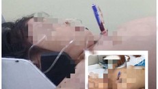 Vấp té khi cầm bút chơi, bé gái suýt chết vì bút đâm xuyên ngực