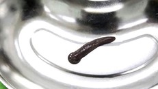 Con đỉa trâu sống trong họng người đàn ông được các BS Bệnh viện Phú Thọ gắp ra