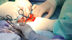 Ca phẫu thuật ghép nối bộ phận sinh dục bị cắt rời.