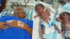 Sức khỏe của người mẹ và cặp sinh đôi đều ổn định. Ảnh: BBC.