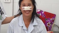 Bệnh nhân mắc bệnh Whitmore ăn cánh mũi đã khỏi bệnh.