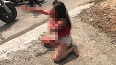 Phẫn nộ: Cô gái bị người tình cũ rạch mặt tàn ác