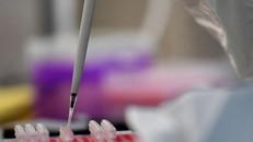 Trung Quốc sử dụng liệu pháp tế bào gốc để điều trị các trường hợp mắc COVID-19 thể nặng