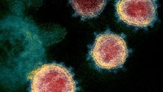 Virus SARS-CoV-2. Ảnh: Reuters