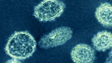 Chủng mới của virus H1N1 đang lây lan mạnh ở Trung Quốc