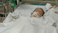 Cháu C. đang được cấp cứu trong tình trạng nguy kịch sau ca mổ lấy đinh nẹp. (Ảnh: Zing)