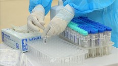 Xét nghiệm sàng lọc virus SARS-CoV-2. Ảnh: TTXVN
