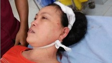  Bà Tượng tại bệnh viện và vết thương do con rể gây ra