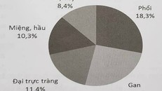 5 loại ung thư thường gặp nhất ở nam giới