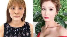 Ngọc trước và sau khi phẫu thuật. Ảnh: Nhân vật cung cấp.