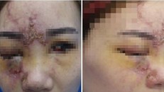 Hình ảnh bệnh nhân khi đến Bệnh viện Da liễu Trung ương.