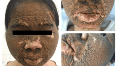  Hình ảnh nữ bệnh nhân (24 tuổi) khi đến khám và điều trị tại bệnh viện. BVTT