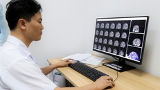 Khi có một trong các dấu hiệu trên mọi người nên đi khám để phát hiện, điều trị kịp thời.