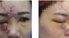 Tưởng làm đẹp hóa… lại xấu