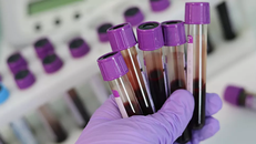 Chẩn đoán ung thư qua một giọt máu