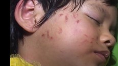 Bé trai 4 tuổi bị bạn đánh 