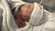 Em bé chào đời kỳ diệu dù tử cung mẹ bị rách