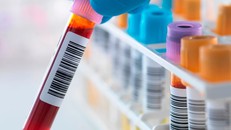 Sắp có ‘máu nhân tạo’ phục vụ các ca cấp cứu khẩn