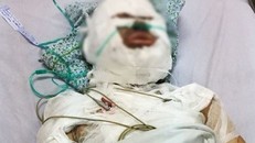 Người đàn ông ngoại quốc tạt xăng đốt người tình trong mộng