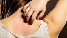 Da ngứa: cảnh báo 7 bệnh nguy hiểm