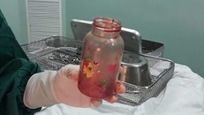 Chiếc bình nhựa sau khi phẫu thuật lấy ra từ bệnh nhân