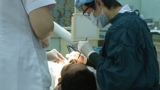 Rụng răng vì thuốc tẩy trắng răng