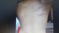 Trò lớp 1 lười học bị cô chủ nhiệm đánh bầm lưng