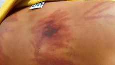 Bé trai 11 tuổi bị 1 người tu hành đánh dã man