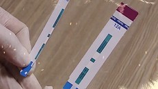 Lập đoàn thanh tra việc sử dụng test thử HIV, viêm gan B tại Bệnh viện Xanh Pôn