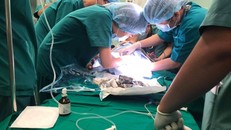 BV Nhi đồng Thành phố đã sẵn sàng phẫu thuật cho cặp song sinh dính nhau phức tạp 