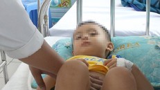 Bé trai 3 tuổi vỡ lá lách khi ngủ gật trên xe máy