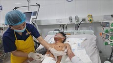 Bệnh nhân bị chấn thương do pháo nổ. Ảnh: TTXVN