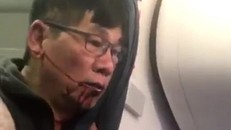 Vị bác sĩ bị thương khi bị cưỡng chế đưa rời khỏi máy bay. 