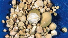 Mất thận vì detox theo phương pháp 'bác sĩ google'