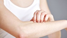 Lạm dụng Vitamin B1 có thể gây phát ban ngứa, khó thở...