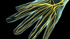 Tê ở ngón, bàn tay, coi chừng bạn đang mắc bệnh nghiêm trọng