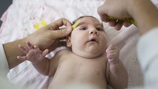 Thai phụ nhiễm Zika không nên quá lo lắng vì tỉ lệ bị dị tật đầu nhỏ chỉ chiếm rất thấp. 