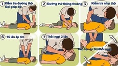 Xử lý cấp cứu khi bị đuối nước. Ảnh: Bệnh viện cung cấp.