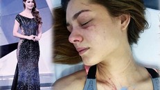 Hoa hậu Trái Đất Venezuela 2012 Osmariel Villalobos bị ca sĩ Diosa cào cấu khắp người. Ảnh: DM.