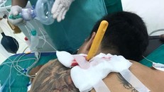 Nam thanh niên bị bạn gái cầm dao đâm lút cán