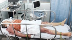 Nạn nhân Thủy vẫn còn hôn mê. Ảnh: Dân trí