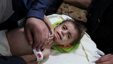 Một em bé tại Ghouta. Ảnh: AP