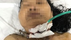 Bà Th. hiện đã qua cơn nguy kịch. Ảnh: Thanh Niên