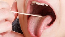 Nhìn miệng đoán bệnh