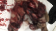 Bàn tay bị dập nát của nạn nhân. Ảnh: TTXVN